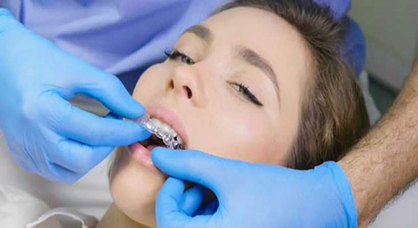 What is Invisalign? - Langmore Dental | Berwick Dentist